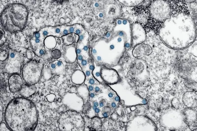 The Untapped Therapeutic Potential of Microbiomics