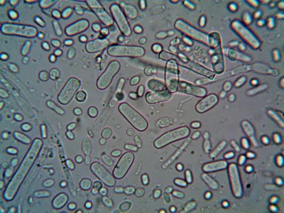 Do you know the logic behind the Upstream and Downstream Processes in Biopharmaceutical Production?